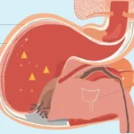 What Does Losing Your Mucus Plug Look Like